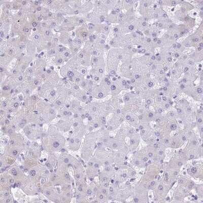 Immunohistochemistry-Paraffin: Galectin-4 Antibody [NBP2-48605]