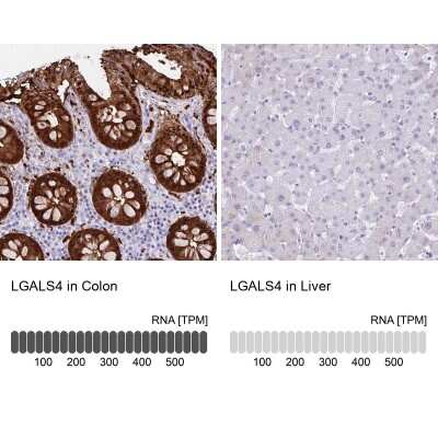 Immunohistochemistry-Paraffin: Galectin-4 Antibody [NBP2-48605]