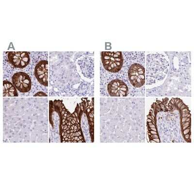 Immunohistochemistry-Paraffin: Galectin-4 Antibody [NBP2-48605]