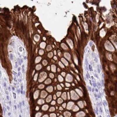 Immunohistochemistry-Paraffin: Galectin-4 Antibody [NBP2-48605]
