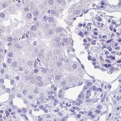Immunohistochemistry-Paraffin: Galectin-4 Antibody [NBP2-48605]