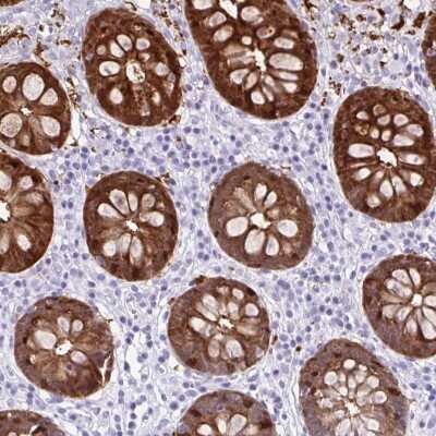 Immunohistochemistry-Paraffin: Galectin-4 Antibody [NBP2-48606]