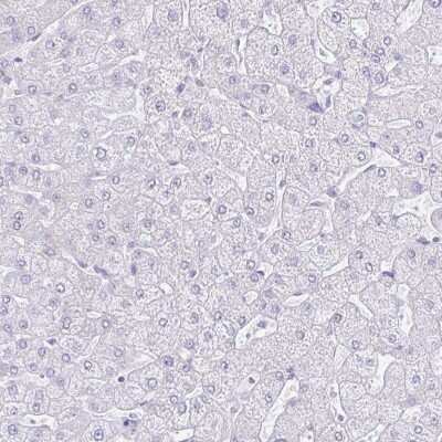 Immunohistochemistry-Paraffin: Galectin-4 Antibody [NBP2-48606]