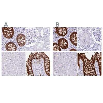 Immunohistochemistry-Paraffin: Galectin-4 Antibody [NBP2-48606]