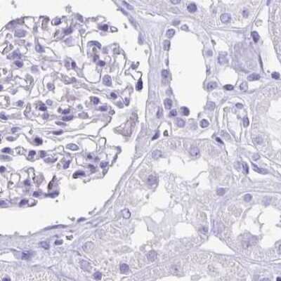 Immunohistochemistry-Paraffin: Galectin-4 Antibody [NBP2-48606]