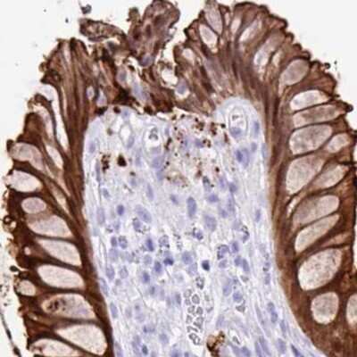 Immunohistochemistry-Paraffin: Galectin-4 Antibody [NBP2-48606]