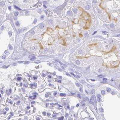 Immunohistochemistry-Paraffin: Galectin-4 Antibody [NBP2-48607]