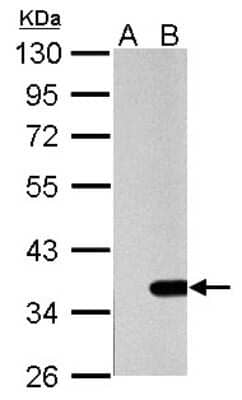 Western Blot: Galectin-4 Antibody [NBP2-16583]