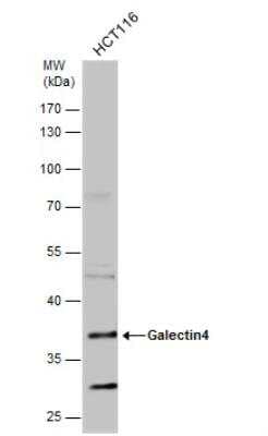 Western Blot: Galectin-4 Antibody [NBP2-21573]