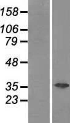 Western Blot: Galectin-4 Overexpression Lysate [NBP2-07660]