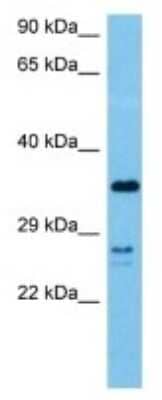 Western Blot: Galectin-6 Antibody [NBP3-10210]