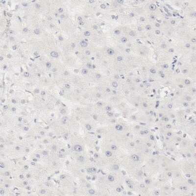 Immunohistochemistry-Paraffin: Galectin-7 Antibody [NBP1-89798]