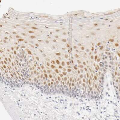 Immunohistochemistry-Paraffin: Galectin-7 Antibody [NBP1-89798]