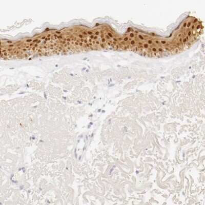 Immunohistochemistry-Paraffin: Galectin-7 Antibody [NBP1-89798]