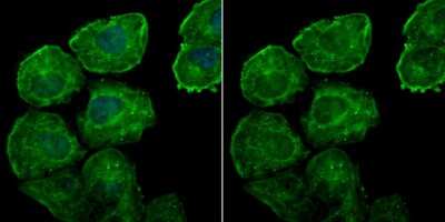 Immunocytochemistry/ Immunofluorescence: Galectin-7 Antibody (JB38-11) [NBP2-75500]