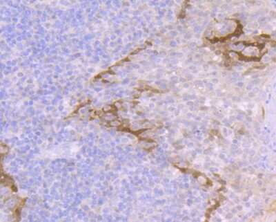 Immunohistochemistry-Paraffin: Galectin-7 Antibody (JB38-11) [NBP2-75500]