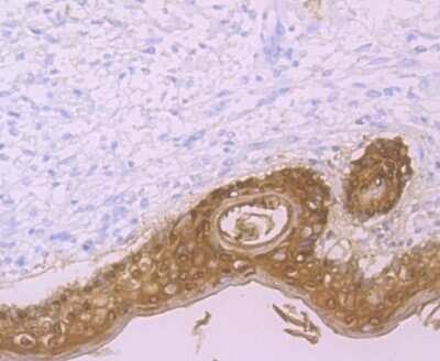 Immunohistochemistry-Paraffin: Galectin-7 Antibody (JB38-11) [NBP2-75500]