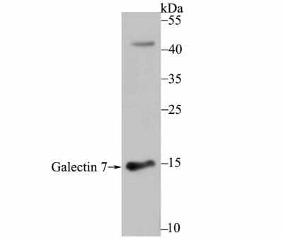 Western Blot: Galectin-7 Antibody (JB38-11) [NBP2-75500]