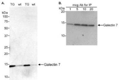 Western Blot: Galectin-7 Antibody [NB100-380]