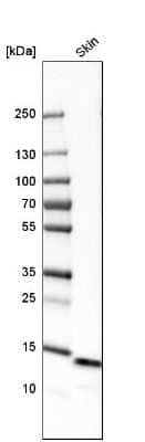 Western Blot: Galectin-7 Antibody [NBP1-89798]