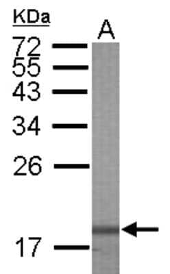 Western Blot: Galectin-7 Antibody [NBP2-16584]