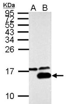 Western Blot: Galectin-7 Antibody [NBP2-21574]