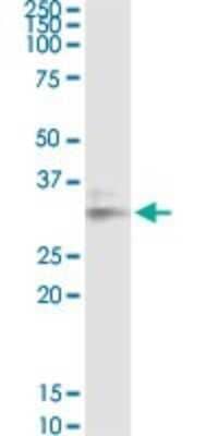 Western Blot: Galectin-8 Antibody (3E5) [H00003964-M01]