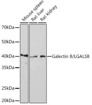 Western Blot: Galectin-8 Antibody (7M9Q9) [NBP3-16397]