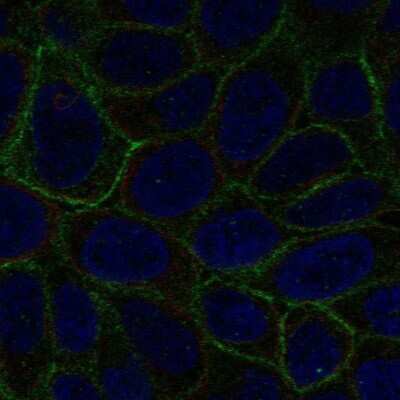 Immunocytochemistry/ Immunofluorescence: Galectin-8 Antibody [NBP2-55285]