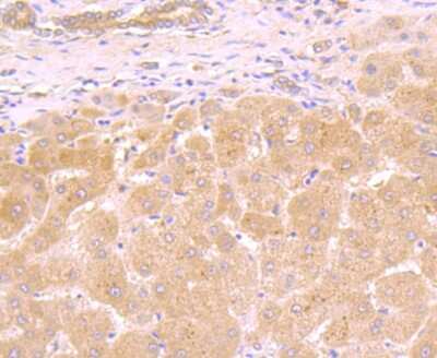Immunohistochemistry-Paraffin: Galectin-8 Antibody (JB85-35) [NBP2-75501]