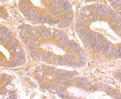 Immunohistochemistry-Paraffin: Galectin-8 Antibody (JB85-35) [NBP2-75501]