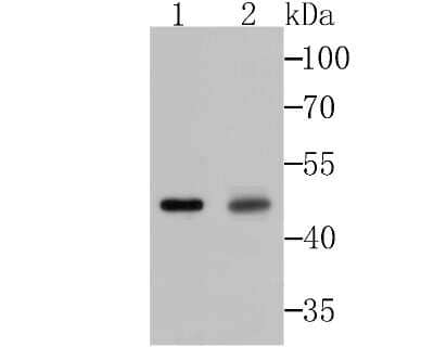 Western Blot: Galectin-8 Antibody (JB85-35) [NBP2-75501]