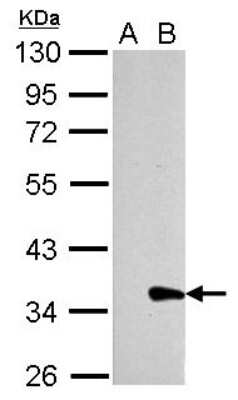 Western Blot: Galectin-8 Antibody [NBP2-16585]