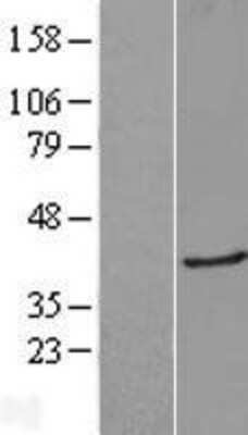 Western Blot: Galectin-8 Overexpression Lysate [NBP2-04592]