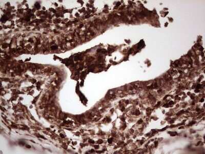Immunohistochemistry: Galectin-9 Antibody (OTI1D12) [NBP2-45619]