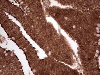 Immunohistochemistry: Galectin-9 Antibody (OTI1D12) [NBP2-45619]