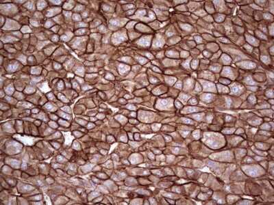 Immunohistochemistry: Galectin-9 Antibody (OTI1D12) [NBP2-45619]