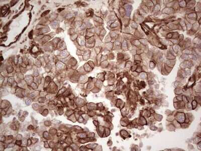 Immunohistochemistry: Galectin-9 Antibody (OTI1D12) [NBP2-45619]