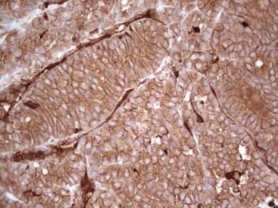 Immunohistochemistry: Galectin-9 Antibody (OTI1D12) [NBP2-45619]