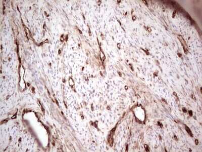 Immunohistochemistry: Galectin-9 Antibody (OTI1D12) [NBP2-45619]