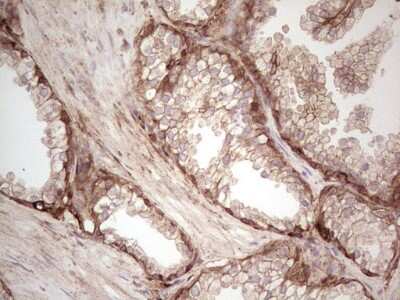 Immunohistochemistry: Galectin-9 Antibody (OTI1D12) [NBP2-45619]