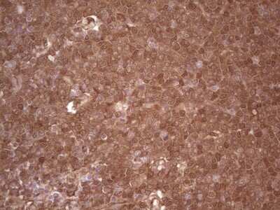 Immunohistochemistry: Galectin-9 Antibody (OTI1D12) [NBP2-45619]