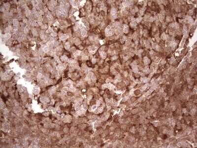 Immunohistochemistry: Galectin-9 Antibody (OTI1D12) [NBP2-45619]