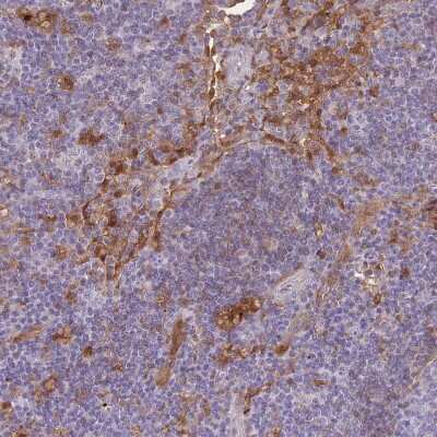 Immunohistochemistry-Paraffin: Galectin-9 Antibody [NBP2-33484]