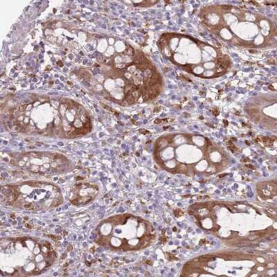 Immunohistochemistry-Paraffin: Galectin-9 Antibody [NBP2-33484]