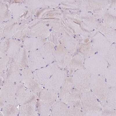 Immunohistochemistry-Paraffin: Galectin-9 Antibody [NBP2-33484]
