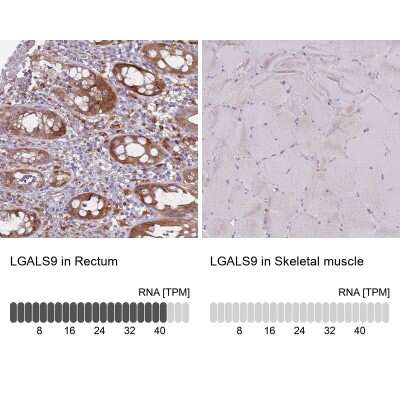 Immunohistochemistry-Paraffin: Galectin-9 Antibody [NBP2-33484]