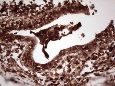 Immunohistochemistry: Galectin-9 Antibody (OTI1D12) - Azide and BSA Free [NBP2-71132]