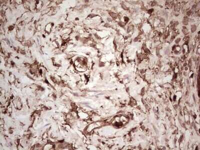 Immunohistochemistry: Galectin-9 Antibody (OTI1D12) - Azide and BSA Free [NBP2-71132]