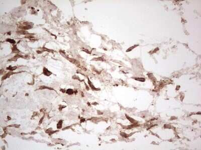 Immunohistochemistry: Galectin-9 Antibody (OTI1D12) - Azide and BSA Free [NBP2-71132]